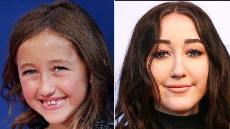 Noah Cyrus antes y después de una supuesta cirugía plástica