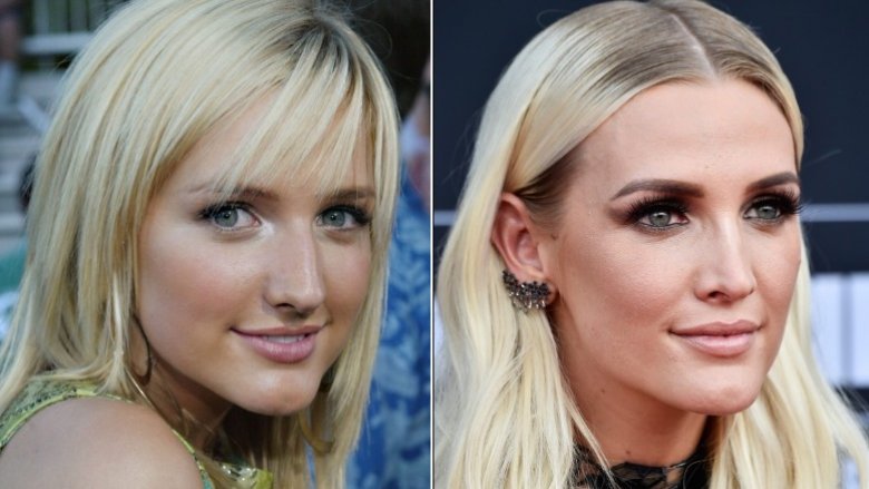 Ashlee Simpson antes y después de la cirugía de nariz