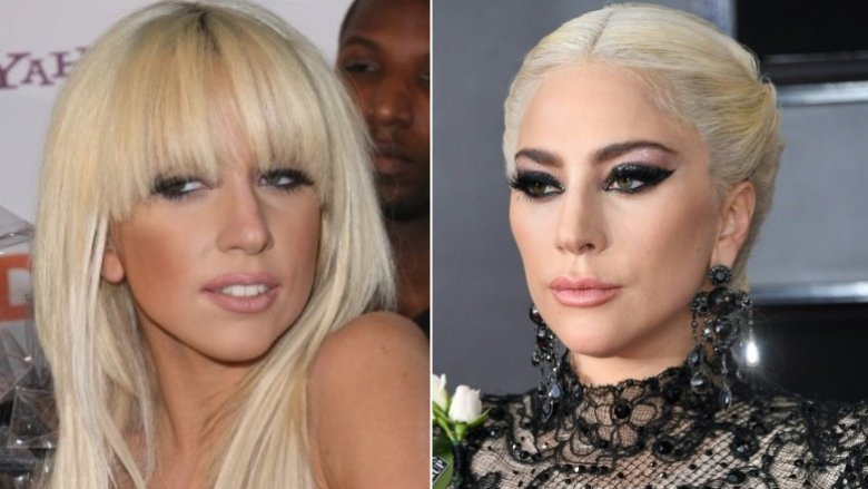 Lady Gaga antes y después de los supuestos rellenos