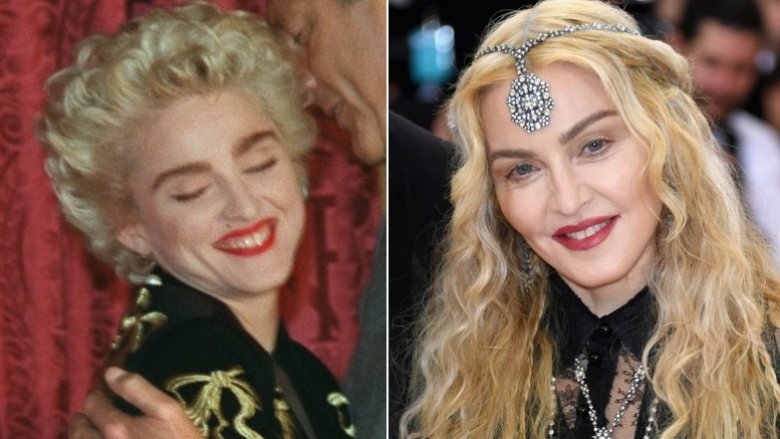 Madonna antes y después de la cirugía plástica