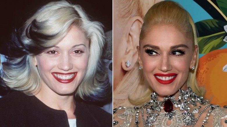 Gwen Stefani antes y después de la cirugía plástica