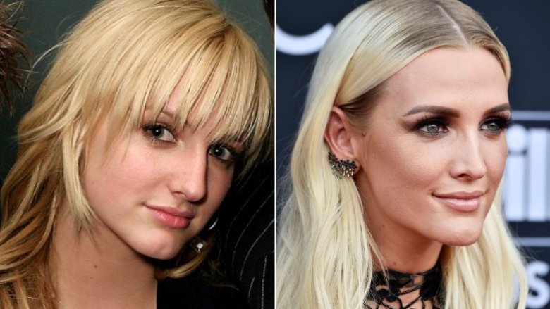 Antes y después de la cirugía de nariz de Ashlee Simpson