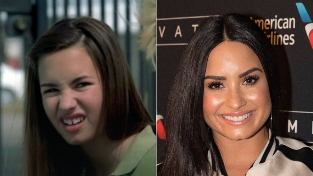 Demi Lovato before and after photos showing off her teeth