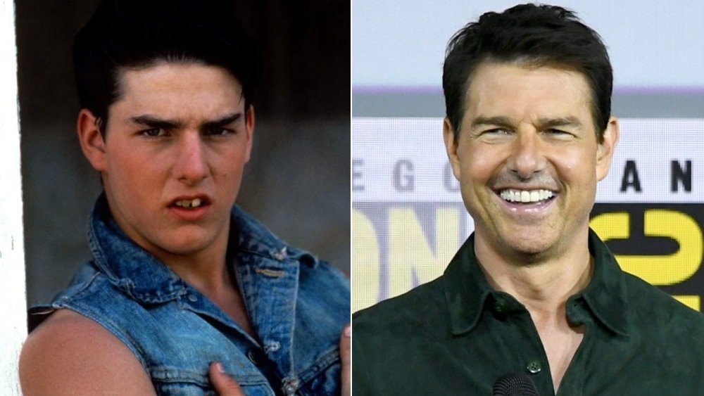 Tom Cruise before and after photos showing off his teeth transformation