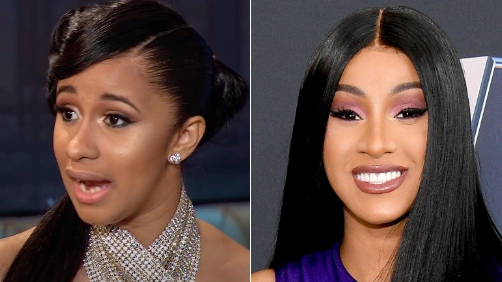 Cardi B before and after photos showing off her teeth transformation