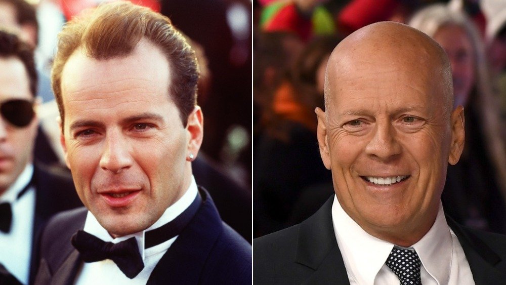 Bruce Willis en un esmoquin a la izquierda con cabello, calvo a la derecha