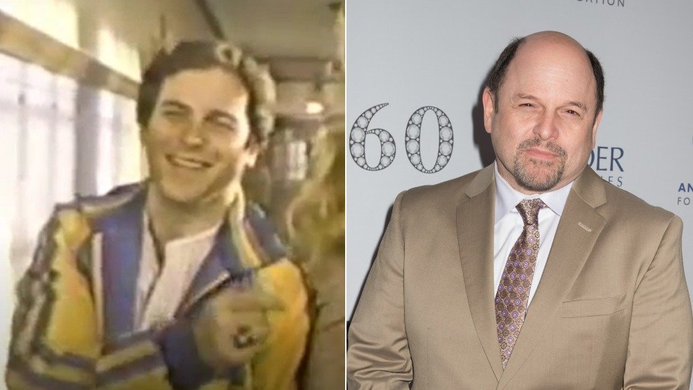 Jason Alexander muy joven y con cabello (izquierda), Jason Alexander calvo con perilla (derecha)